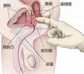 男性前列腺图
